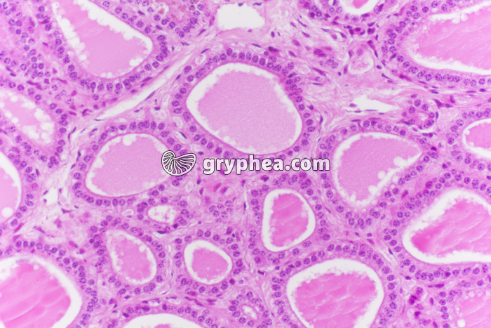 Thyroïde normale x100 - gryphea.com